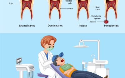 The Root of the Matter (RCT)